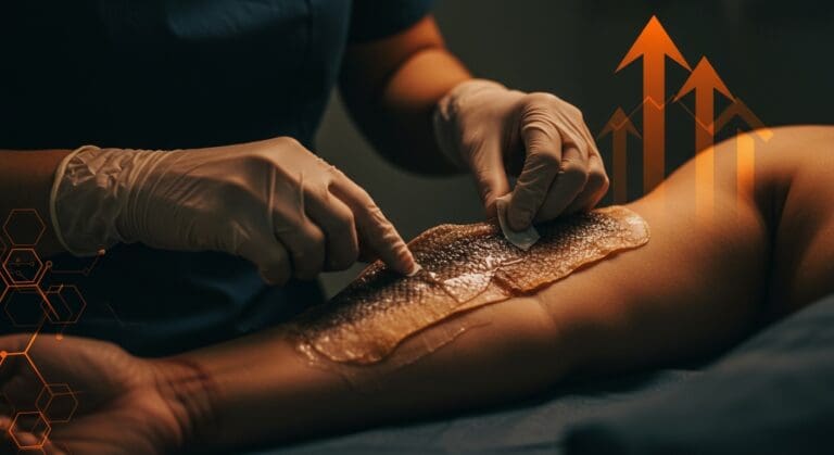 Innovación médica en Brasil con tratamiento de quemaduras usando piel de tilapia en soluciones sostenibles de salud pública.